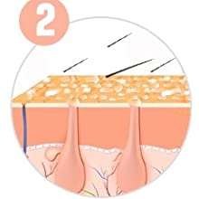 Epilatore luce pulsata modalita utilizzo 1