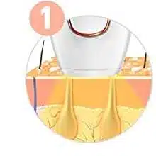 VANITY VENICE Hair Removal 9 Epilatore luce pulsata modalita utilizzo 2