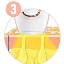 VANITY VENICE Hair Removal 11 Epilatore luce pulsata modalita utilizzo 3